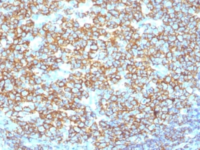 view_image-46 view image 46- Immunomart