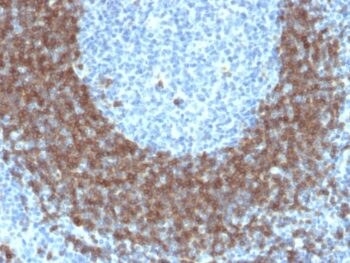 CD79b (B-Cell Marker)(IGB/1842), 1mg/mL