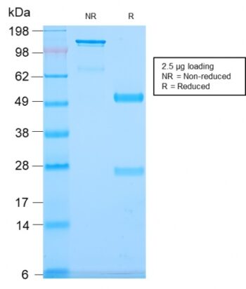 CD79b (B-Cell Marker)(IGB/2940R), 0.2mg/mL
