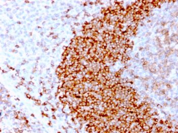 CD79b (B-Cell Marker)(IGB/3170R), 0.2mg/mL