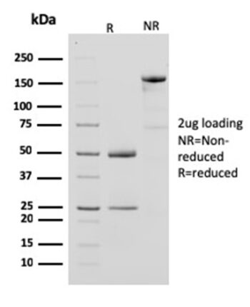 Creatine Phosphokinase-BB (CK-BB)(CPTC-CKB-2), 0.2mg/mL