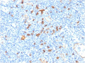 IL3RA / CD123 (Acute Myeloid Leukemia Marker) (IL3RA/1531), CF647 conjugate, 0.1mg/mL