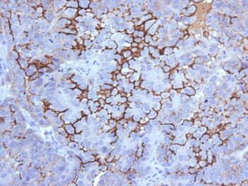 MUC16 / CA125 (Ovarian Carcinoma Marker)(500000000000), CF640R conjugate, 0.1mg/mL