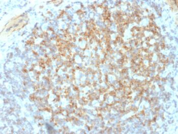 CD61 / Integrin 3 / Platelet Glycoprotein IIIa (Platelet Marker)(ITGB3/2145), 0.2mg/mL