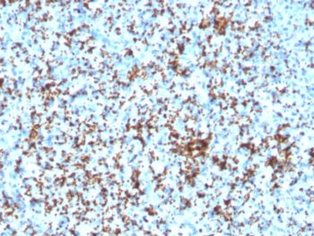 CD61 / Integrin 3 / Platelet Glycoprotein IIIa (Platelet Marker)(ITGB3/3126R), 0.2mg/mL