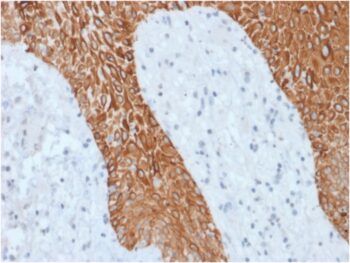 Cytokeratin, Multi (Epithelial Marker)(KRT/1877R), CF568 conjugate, 0.1mg/mL