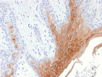 Cytokeratin 10 (KRT10) (Suprabasal Epithelial Marker) (KRT10/1990R), CF640R conjugate, 0.1mg/mL