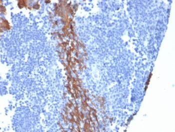 Cytokeratin 13 (Non-Keratinized Squamous Epithelial Marker)(KRT13/2213), CF488A conjugate, 0.1mg/mL