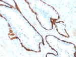 Cytokeratin 15 (Esophageal Squamous Cell Carcinoma Marker)(KRT15/2554), CF594 conjugate, 0.1mg/mL 1 view_image-520