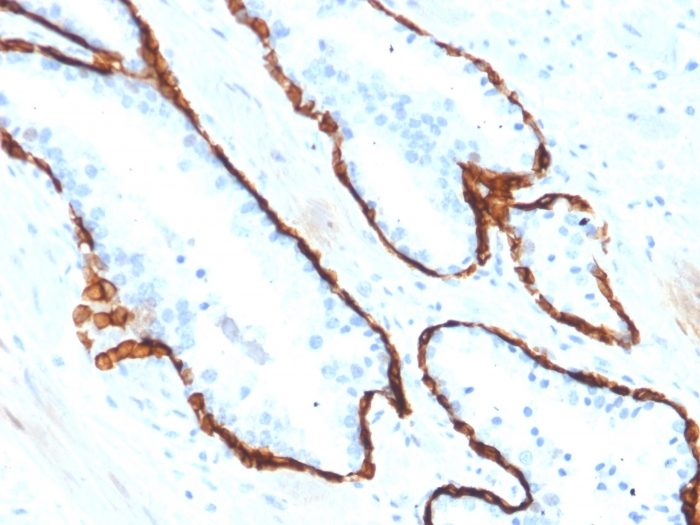 view_image-520 view image 520- Immunomart