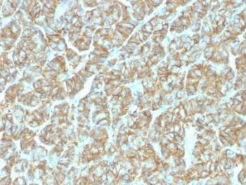 Ep-CAM / CD326 (Epithelial Marker) (EGP40/1555R), CF568 conjugate, 0.1mg/mL