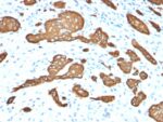 Cytokeratin 8 (KRT8)(KRT8/2115), 0.2mg/mL 1 view_image-535