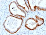 Cytokeratin, Basic (Type II or HMW)(KRTH/2147R), Biotin conjugate, 0.1mg/mL