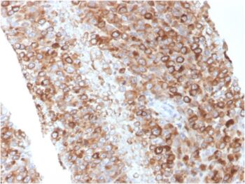 CD63 (Late Endosomes Marker)(LAMP3/2881), 0.2mg/mL