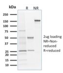 Langerin / CD207 (Marker of Langerhans Cells)(LGRN/1821), CF568 conjugate, 0.1mg/mL 1 view_image-544
