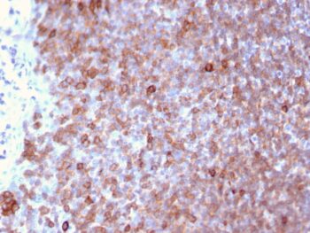 Lymphocyte Specific Protein 1 (LSP1) / pp52(LSP1/3025), CF740 conjugate, 0.1mg/mL