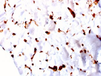 FABP5 (Marker of Metastatic Potential in Colorectal Cancer)(CPTC-FABP5-3), CF568 conjugate, 0.1mg/mL