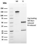 MCAM (Melanoma Cell Adhesion Molecule) / MUC18 / CD146(MCAM/3179), Biotin conjugate, 0.1mg/mL