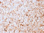 Mammaglobin (SCGB2A2) (Breast Cancer Marker)(MGB1/2682R), CF740 conjugate, 0.1mg/mL 1 view_image-566