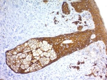 Cytokeratin, Basic (Type II or HMW) (Epithelial Marker) (KRTH/1576R), CF647 conjugate, 0.1mg/mL