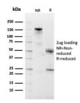 CD10 (Membrane Metalloendopeptidase)(MME/2590), 1mg/mL