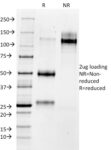 MMP3 (Marker of Metastasis and Rheumatoid Arthritis)(MMP3/1730), CF568 conjugate, 0.1mg/mL 1 view_image-579