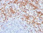 MMP9 (Matrix Metalloproteinase 9)(MMP9/2477), CF647 conjugate, 0.1mg/mL 1 view_image-583