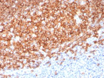 CD20 / MS4A1 (B-Cell Marker)(MS4A1/3410), 0.2mg/mL
