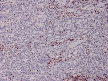 MSH2 (DNA Mismatch Repair Marker)(MSH2/2622), CF568 conjugate, 0.1mg/mL