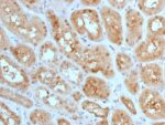 MTAP (Tumor Suppressor Marker) (MTAP/1813), 0.2mg/mL