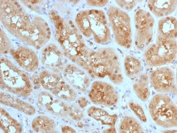 MTAP (Tumor Suppressor Marker) (MTAP/1813), 0.2mg/mL