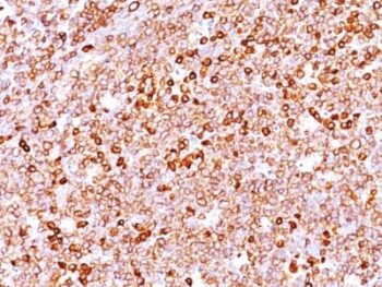CD79a (IGA/1688R), 0.2mg/mL