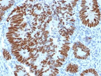 p53 Tumor Suppressor Protein(N/A), 0.2mg/mL