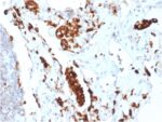 Napsin A (Lung Adenocarcinoma Marker)(NAPSA/1865R), CF647 conjugate, 0.1mg/mL