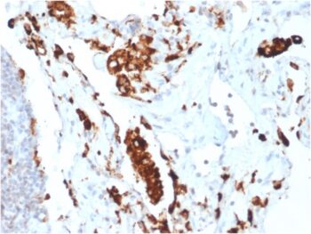Napsin A (Lung Adenocarcinoma Marker)(NAPSA/1865R), CF647 conjugate, 0.1mg/mL