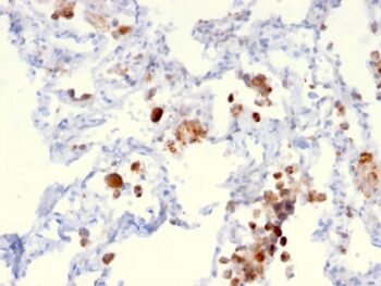 Napsin A (Lung Adenocarcinoma Marker)(NAPSA/3306), CF640R conjugate, 0.1mg/mL