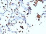 Napsin A (Lung Adenocarcinoma Marker)(NAPSA/3308), 1mg/mL