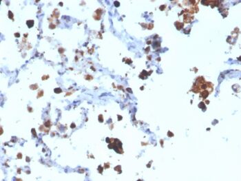 Napsin A (Lung Adenocarcinoma Marker)(NAPSA/3308), 1mg/mL