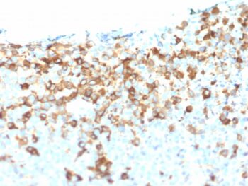 NGF-Receptor (p75) / CD271 (Soft Tissue Tumor Marker) (NGFR/1964), CF488A conjugate, 0.1mg/mL