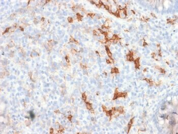 NGF-Receptor (p75) / CD271 (Soft Tissue Tumor Marker) (NGFR/1997R), CF488A conjugate, 0.1mg/mL