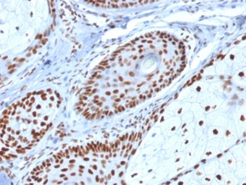 Nucleophosmin (Acute Myeloid Leukemia Marker)(NPM1/1902), CF740 conjugate, 0.1mg/mL