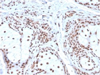 Nucleophosmin (Acute Myeloid Leukemia Marker)(NPM1/3286), CF647 conjugate, 0.1mg/mL