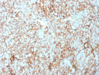 CD73 (Immuno-Oncology Target)(NT5E/2503), 0.2mg/mL