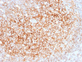 CD73 (Immuno-Oncology Target)(NT5E/2545), 0.2mg/mL