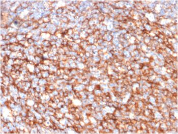 CD73 (Immuno-Oncology Target)(NT5E/2646), 0.2mg/mL
