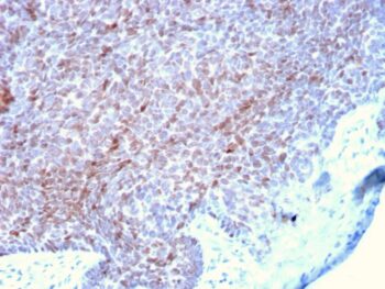 p73 (Tumor Suppressor)(P73/2531), 0.2mg/mL
