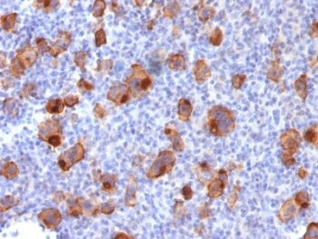 CD30 / TNFRSF8 (Hodgkin & Reed-Sternberg Cell Marker) (Ki-1/1747R), 0.2mg/mL