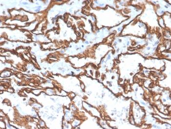 CD31 / PECAM-1 (Endothelial Cell Marker)(PECAM1/3529), 0.2mg/mL