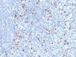 Perforin-1 (Pore Forming Protein) (Apoptosis Marker)(PRF1/2470), 1mg/mL