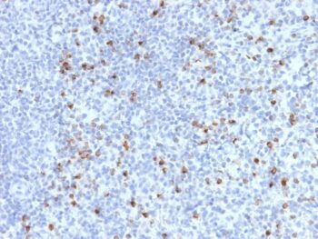 Perforin-1 (Pore Forming Protein) (Apoptosis Marker)(PRF1/2470), 1mg/mL
